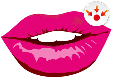 Lippenherpes Behandeln Lippenherpes Behandeln