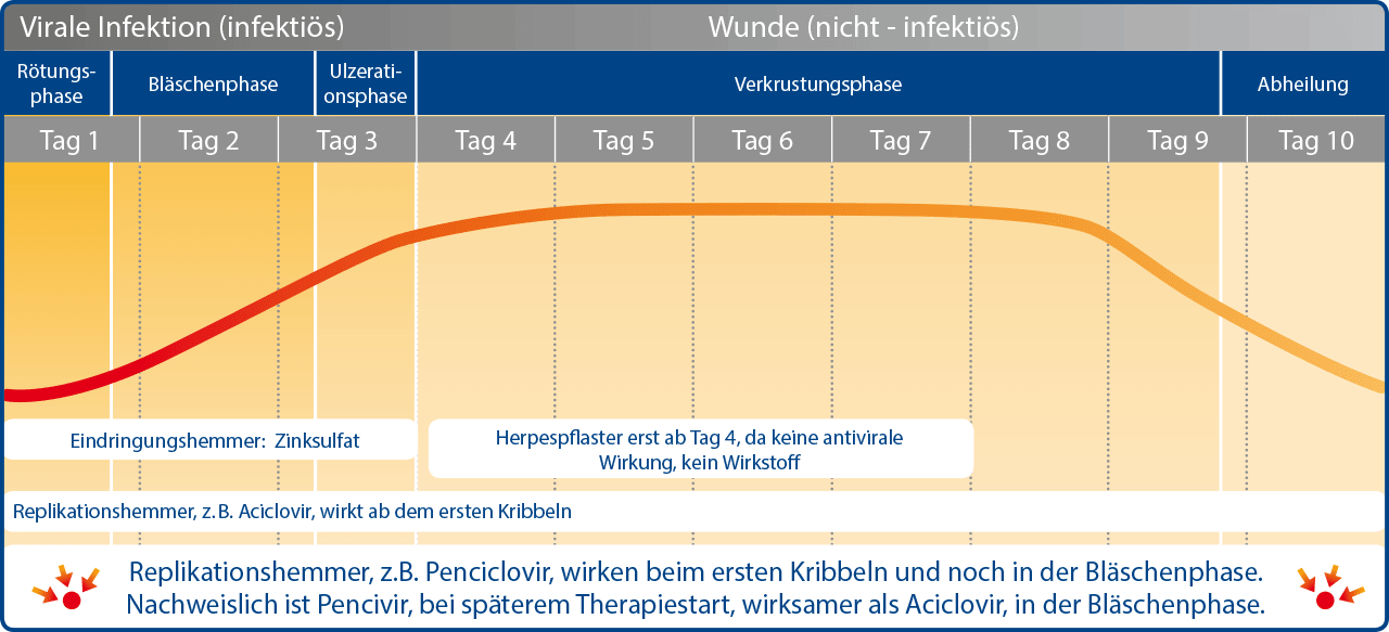 Verlauf Eines Lippenherpes Ausbruchs Pencivir